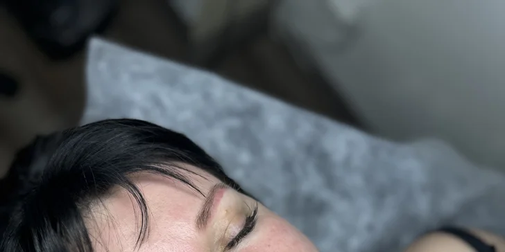 Mikrojehličkování stimuluje tvorbu kolagenu, redukuje vrásky a posiluje vlasové kořínky.