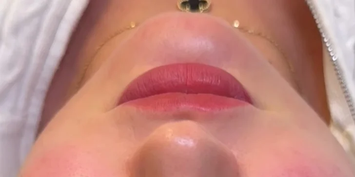 Na výběr máte expresní ošetření, 6 v 1 pro omlazení či biostimulační peeling pro regeneraci.