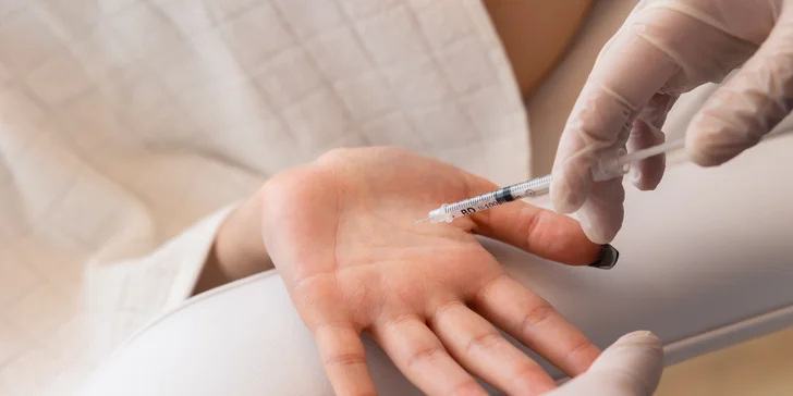 Botulotoxín pomáha aj pri nadmernom potení dlaní, chodidiel či podpazušia