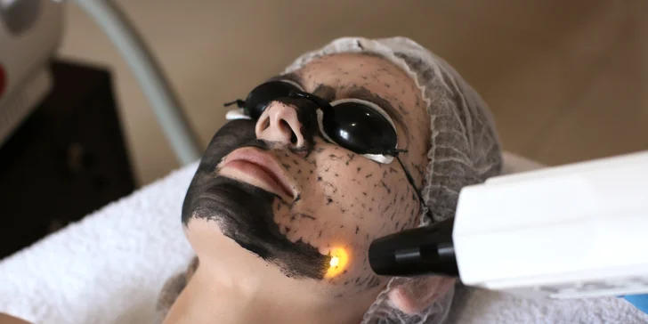 Uhlík, nanesený na tvár, následne na seba naviaže nečistoty, toxíny a odumreté kožné bunky z pórov, ktoré sa odstránia šetrným laserom.