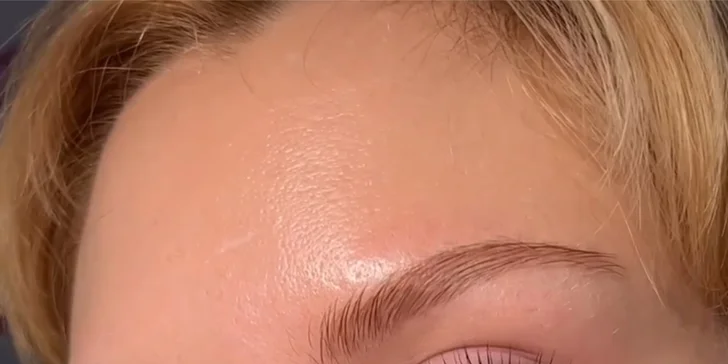 Po laminaci získá vaše obočí plný vzhled a pozvednutý tvar.