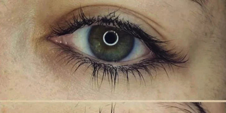 Vhodné aj pre zničené mihalnice po 3D.