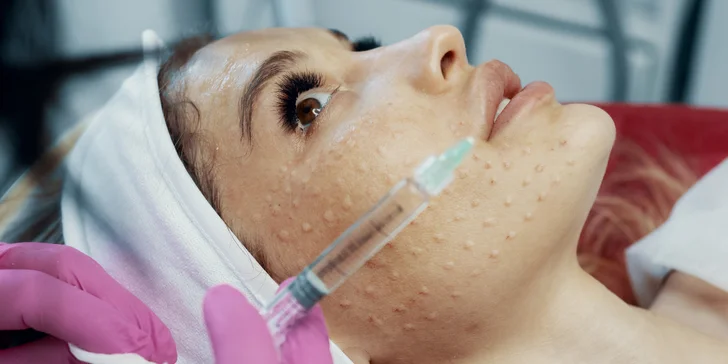 Účinné látky jsou do pokožky v oblasti obličeje a krku vpravovány pomocí drobných vpichů mikrojehliček na hlavici přístroje. 