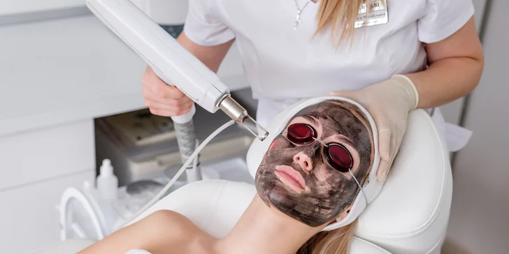 Laserový karbónový peeling vhodný pre problematickú pleť