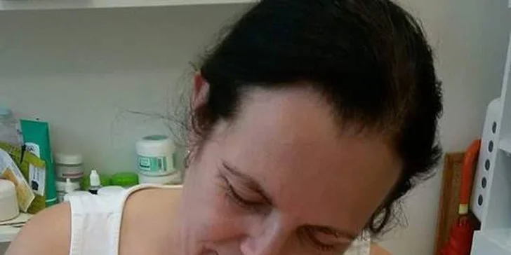 Fotochromatický ultrazvuk pomáhá omlazení pokožky, jejímu zjemnění i zpevnění.