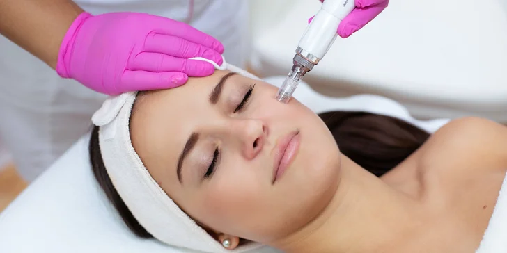 Mikrojehličkování v klinice PRO visage: 5 metod pro každého