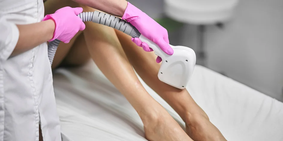Laserová epilace: krk, záda, nohy, intimní partie a další