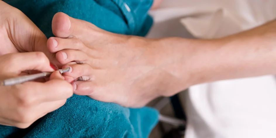 Péče o nohy: kuří oka, zarostlé nehty, ortonyxie i pedikúra