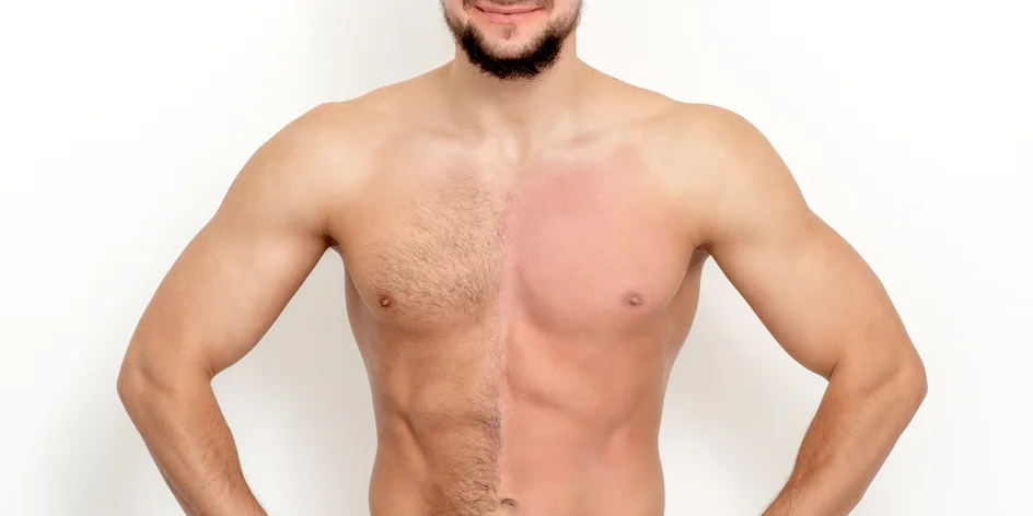 Depilace cukrovou pastou pro ženy i muže