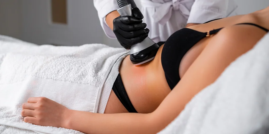 Kavitace: laserová lipolýza pro redukci tuku, 1–10 ošetření