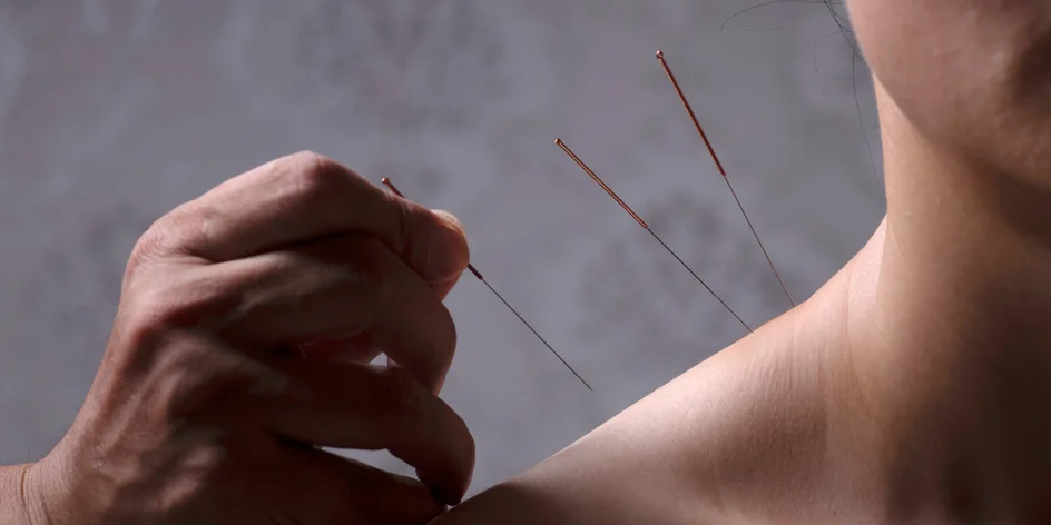 Akupunktura s hloubkovou zdravotní masáží