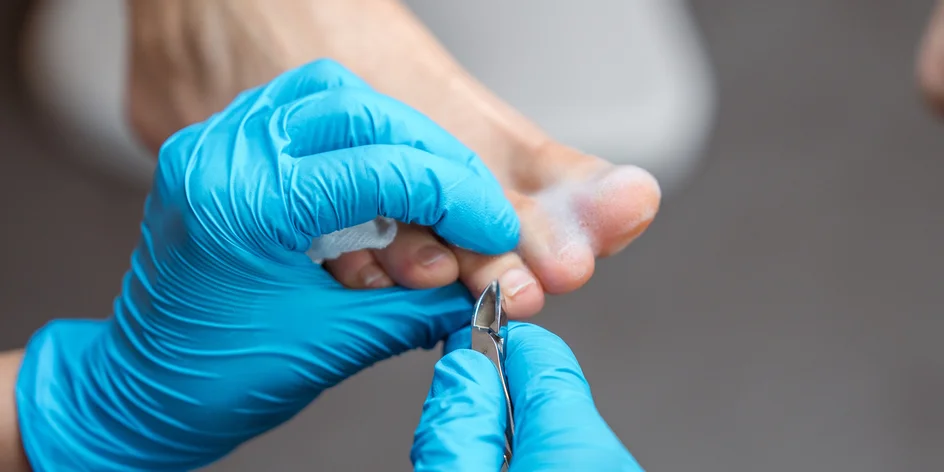 Péče o nohy: kuří oka, zarostlé nehty, ortonyxie i pedikúra