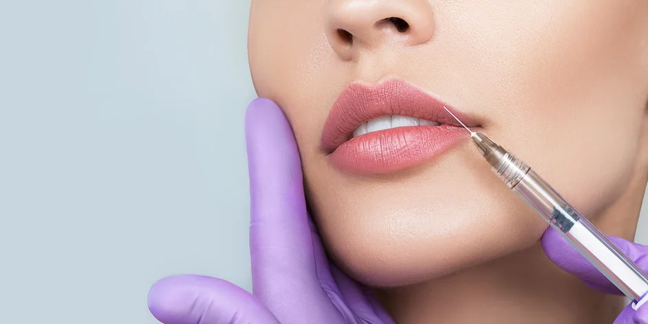 Výplň a hydratácia pier jemnou kyselinou hyalurónovou