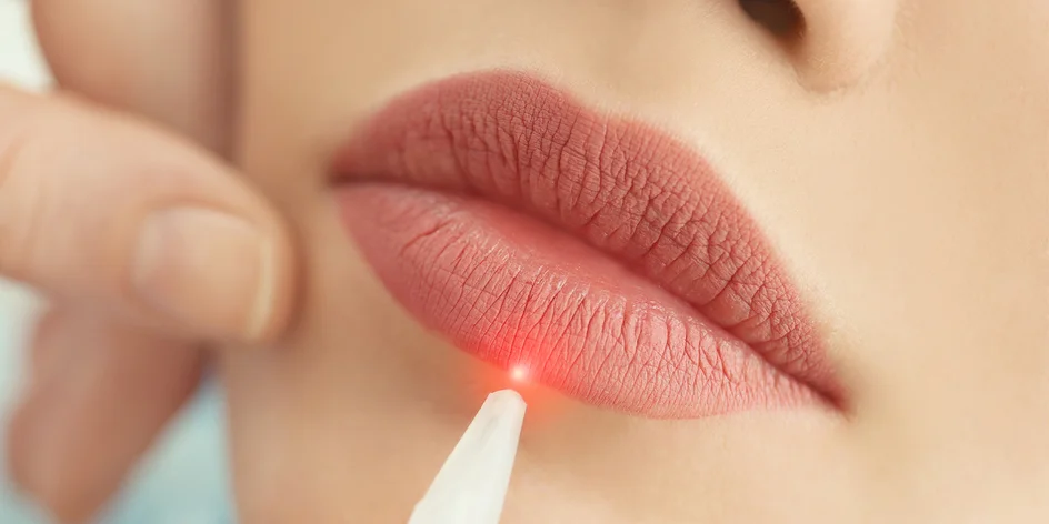 Zväčšenie pier alebo omladenie očného okolia pomocou laseru