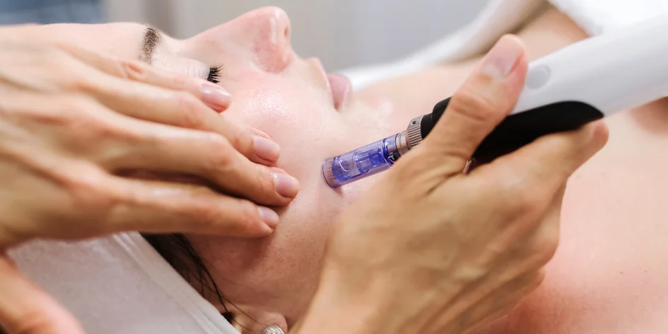 Hyaluron Pen: korekce vrásek či mírné zvětšení rtů