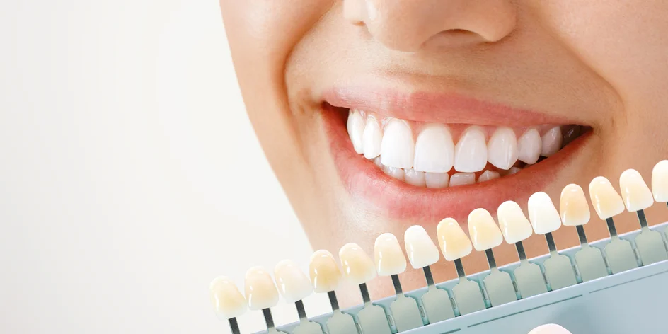 Šetrné bělení zubů včetně dentální hygieny s air-flow